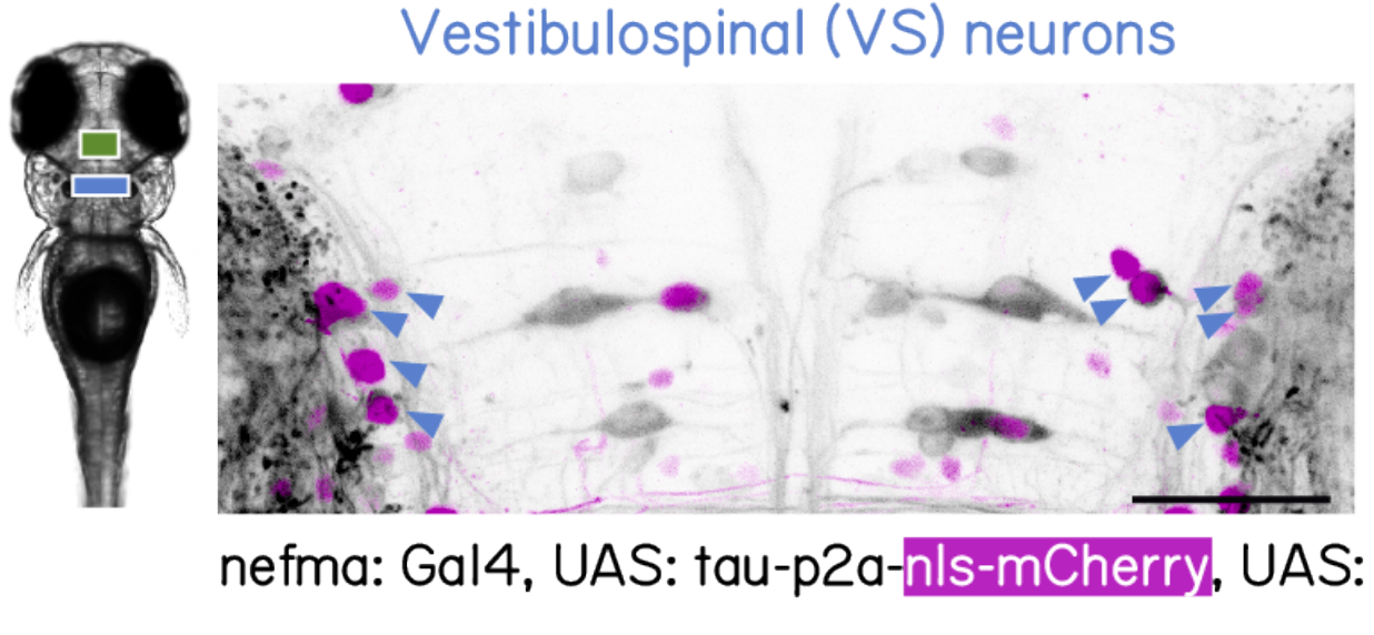 tau-brainstem-balance.png